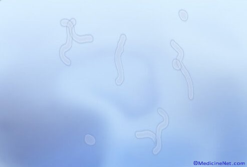 What are eye floaters and why do we get them?