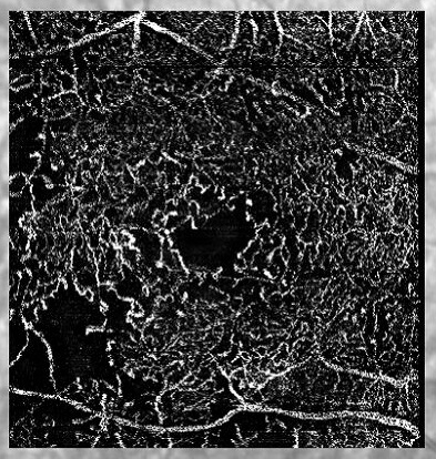 A Simple Eye Exam Could One Day Be The Key To Diagnosing Alzheimer’s Disease Early